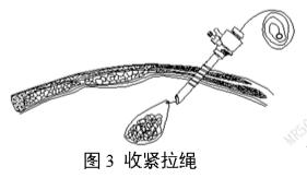 一次性使用內(nèi)窺鏡用活檢袋注冊審查指導原則（2025年第20號）(圖3)