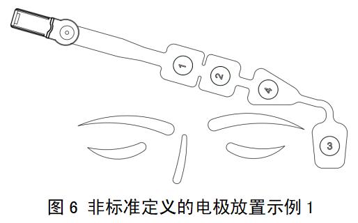 一次性使用腦電電極注冊審查指導原則（2022年第35號）(圖5)