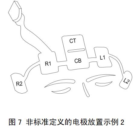 一次性使用腦電電極注冊審查指導原則（2022年第35號）(圖6)